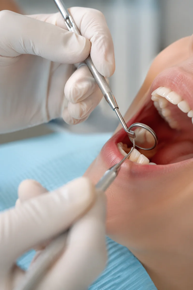 Routine Dental Examination Close Up