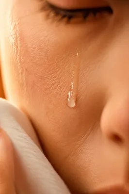 Tear on Cheek with Gentle Comfort