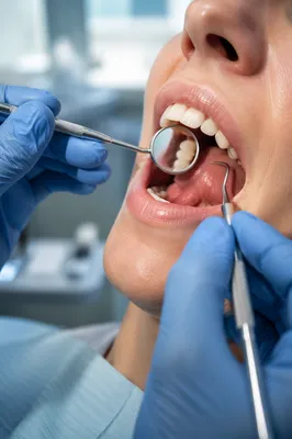 Calm Dental Examination with Blue Gloves