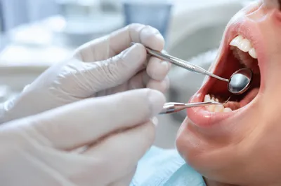 Routine Dental Examination in Modern Clinic