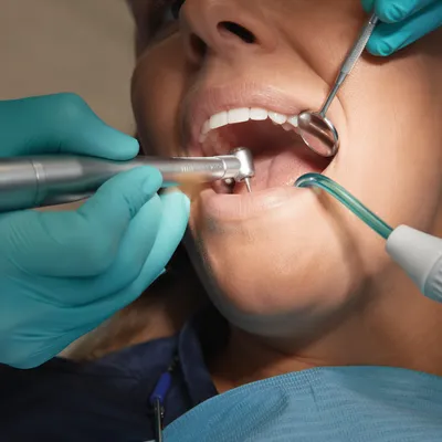 Routine Dental Checkup Close-Up Scene