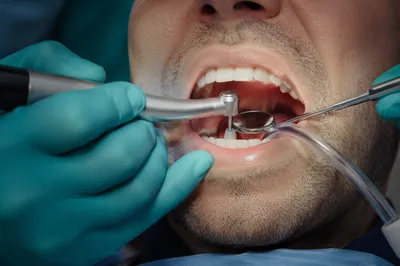 Routine Dental Checkup Close-Up Scene