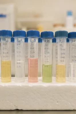 Laboratory Test Tubes in Soft Clinical Light