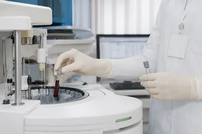 Clinical Lab Technician Handling Blood Test Tubes