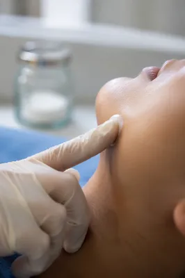 Medical Skincare Cream Applied to Cheek