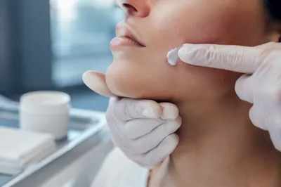 Dermatology Cream Application Close Up