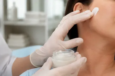 Clinical Skincare Cream Applied to Patient Cheek