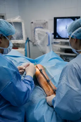 Orthopedic Surgery Team in Sterile Operating Room