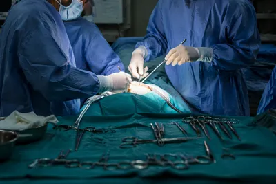 Surgical Team Working in Operating Room