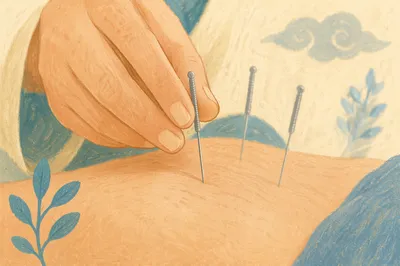 Calm Acupuncture Wellness Treatment Close Up