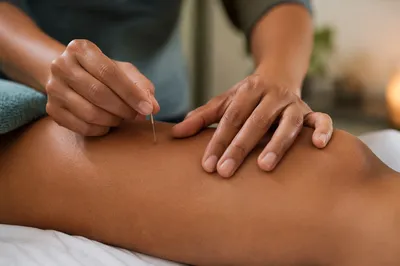 Close-Up Acupuncture Wellness Treatment